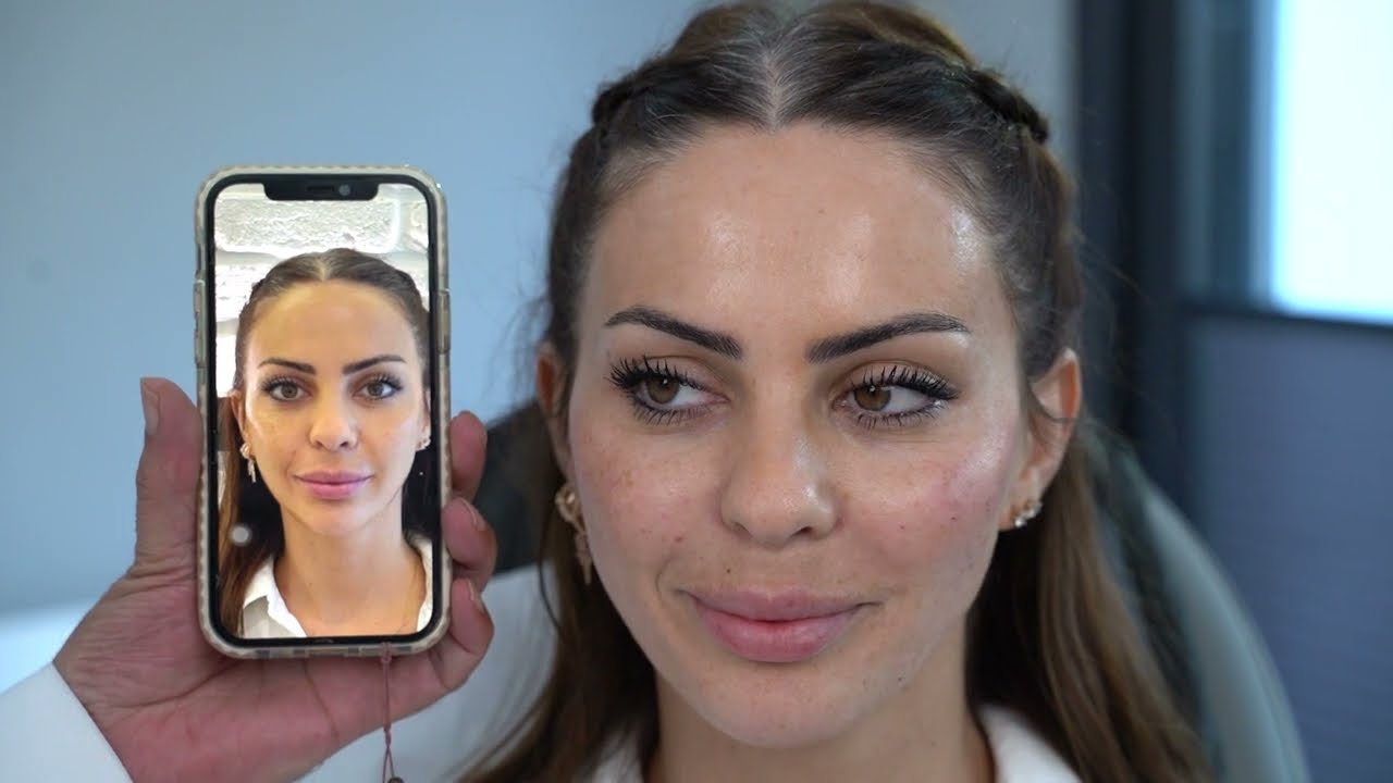 Opera Dolgu ve Bella Vita Uygulaması - Medicaline