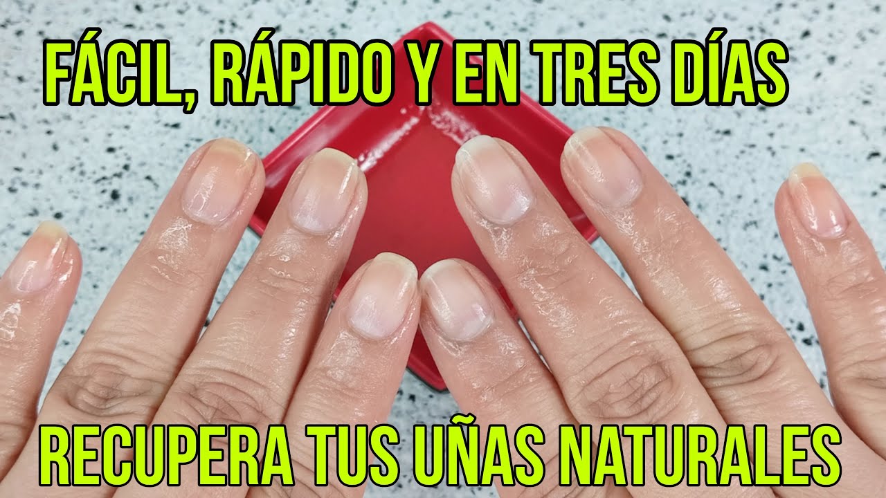 Así de fácil recupera uñas quebradizas y escamosas en 3 días. Receta para crecer uñas naturales
