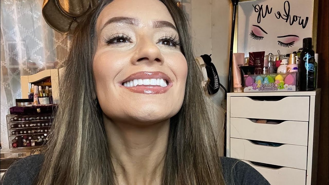 NEW TEETH (fixed bridge!)REVEAL & UPDATES!!