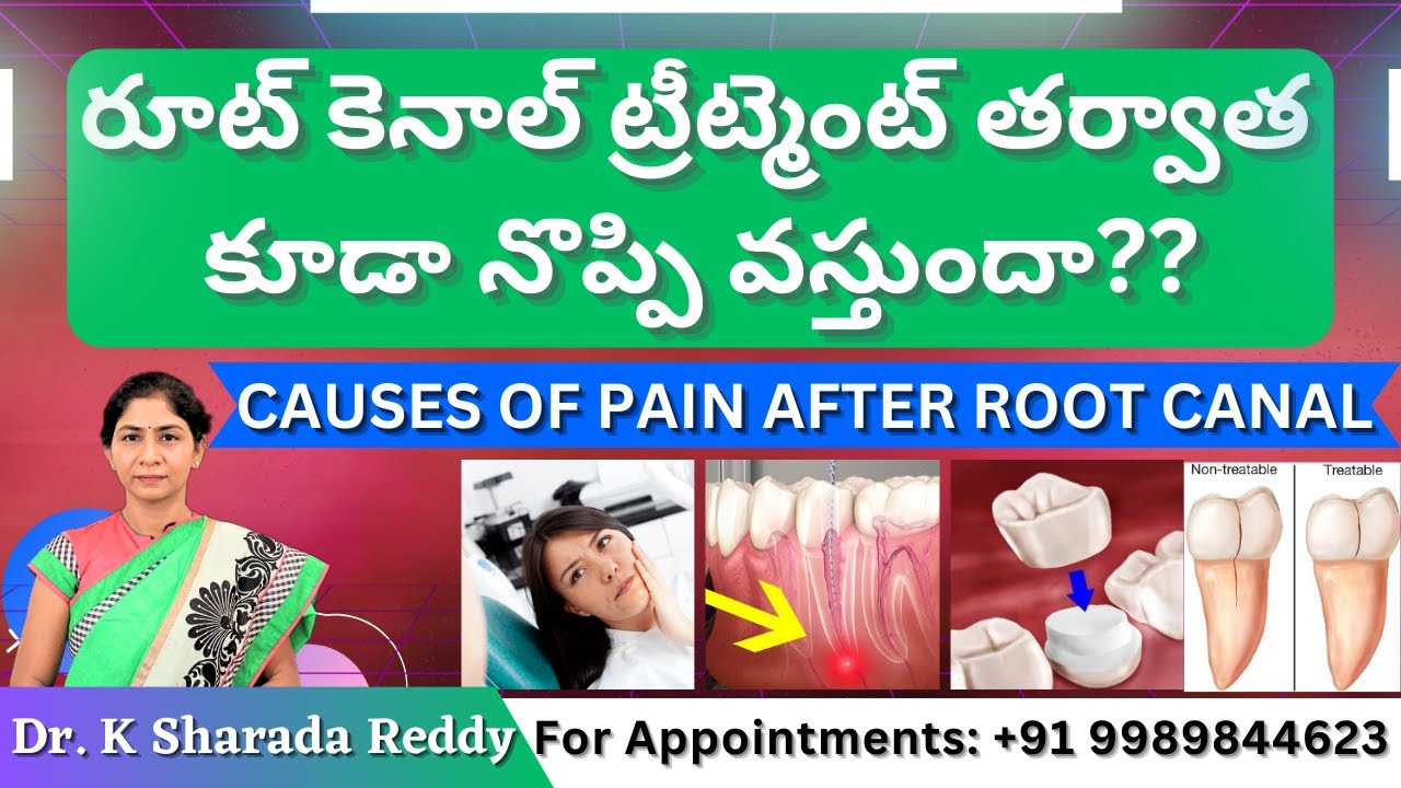 రూట్ కెనాల్ ట్రీట్మెంట్ తర్వాత కూడా నొప్పి వస్తుందా? Causes of Tooth pain after RCT - by Dr. Sharada