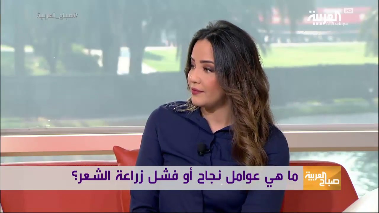 لقاء الدكتور شادي زارع في برنامج صباح العربية والحديث حول زراعة الشعر بين النجاح والفشل