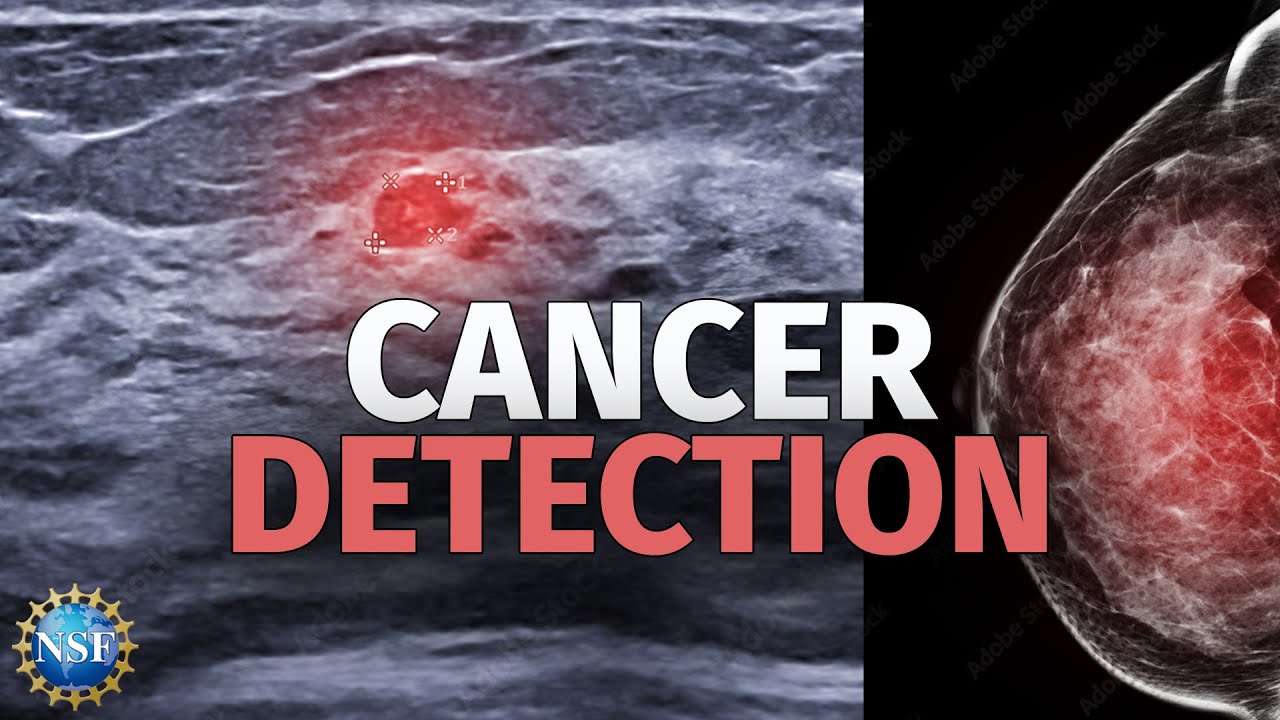 Breakthrough Breast Cancer Detection Tech