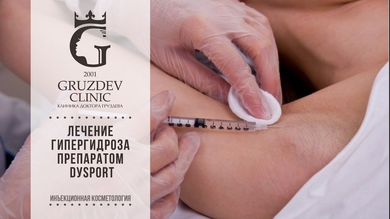 Лечение гипергидроза препаратом Dуsport