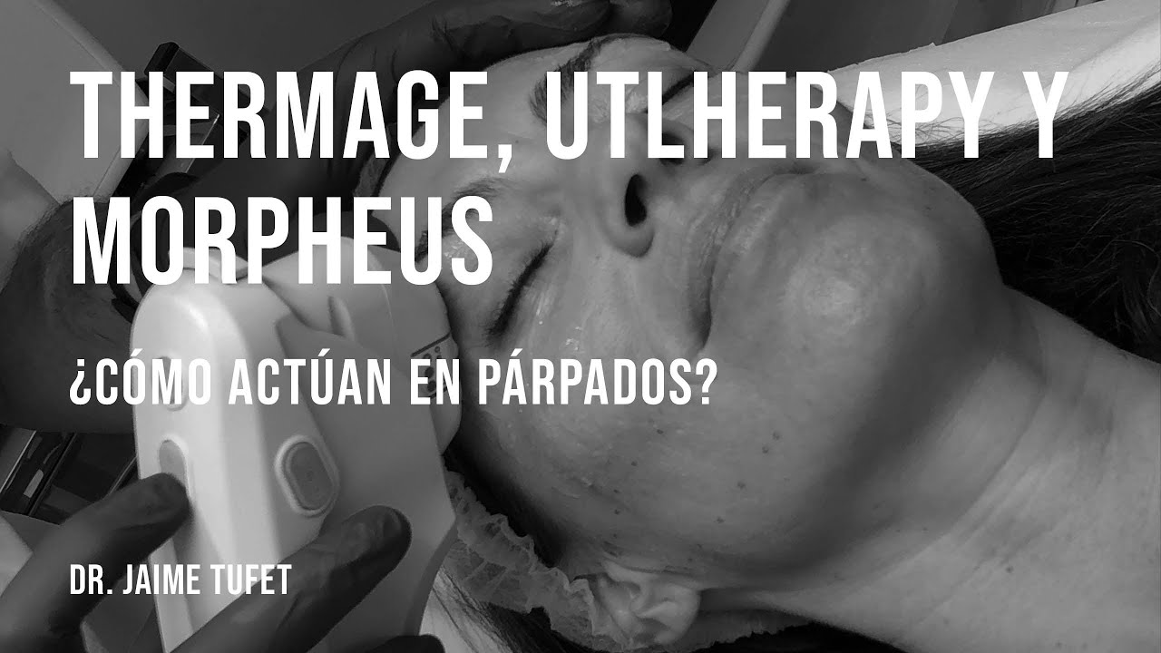 Thermage, Utlherapy y Morpheus ¿cuál es mejor en párpados?