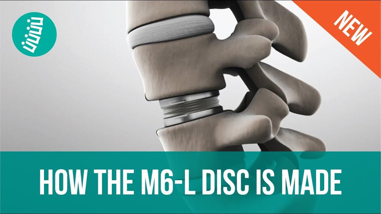 M6-L Artificial Disc Replacement (ADR): How it’s Made