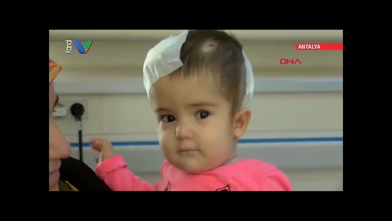 Her Yıl Bin Bebekten Üçü Omuriliği Dışarıda Doğuyor