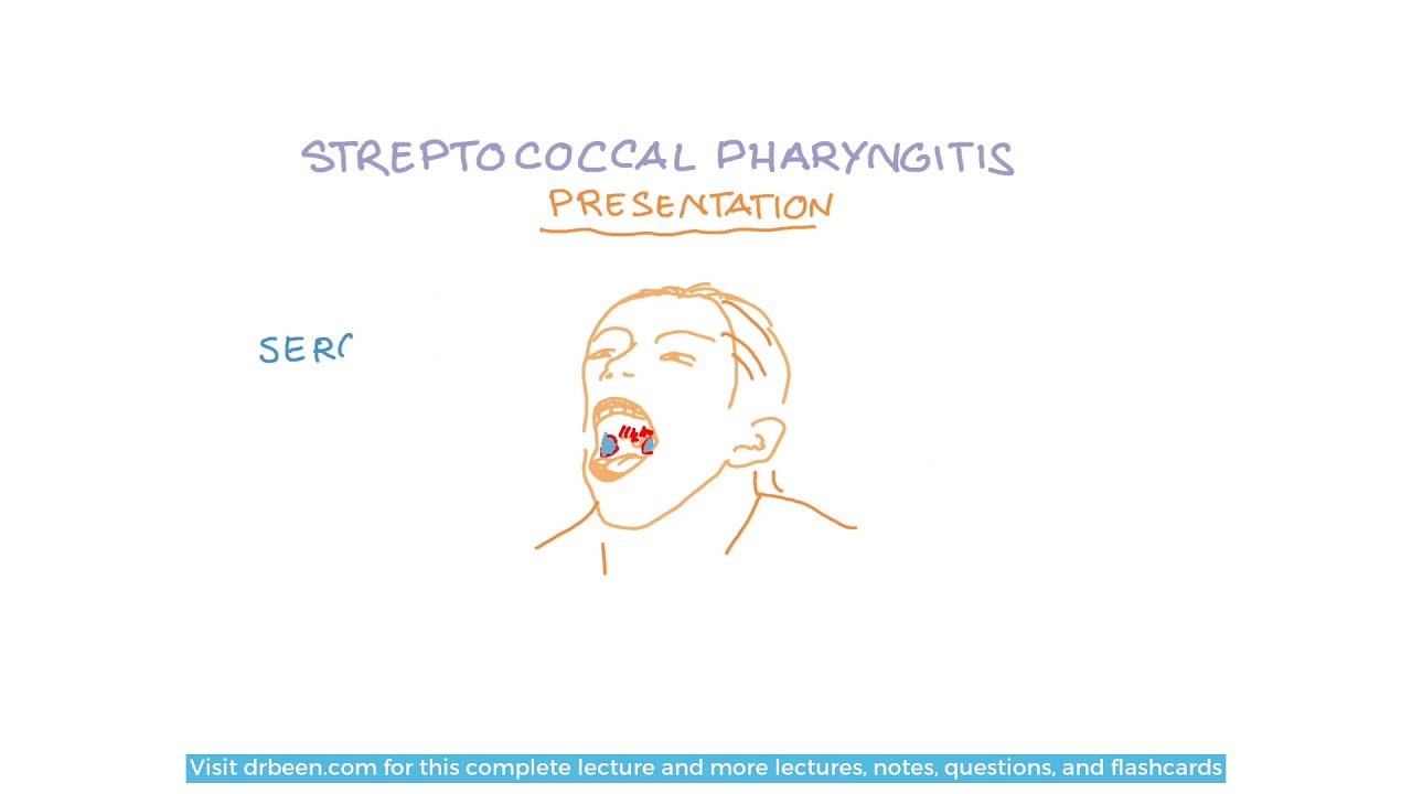 Streptococcus Pyogenes - Diseases and Their Management