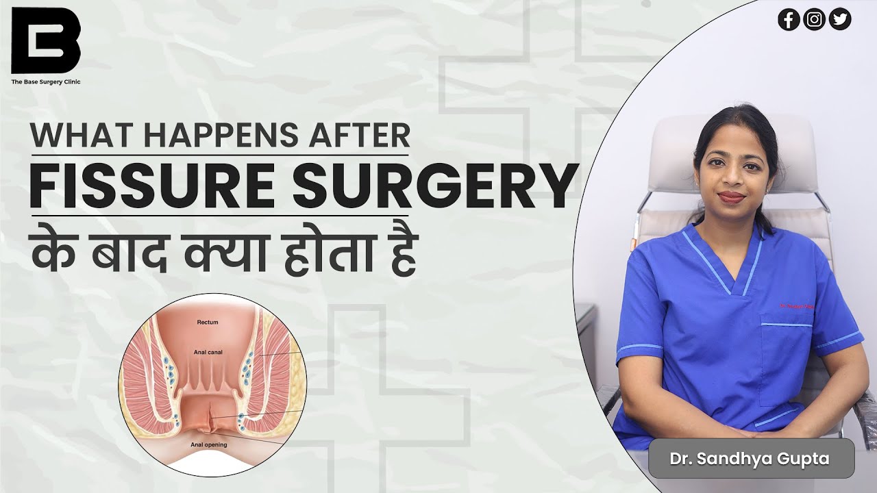 What happens after Fissure surgery? | What happens after Fissure surgery? - Dr. Sandhya Gupta #piles