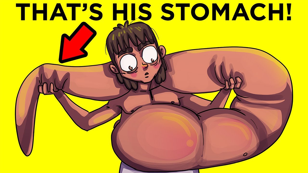 Why This Man NEVER Stopped Eating