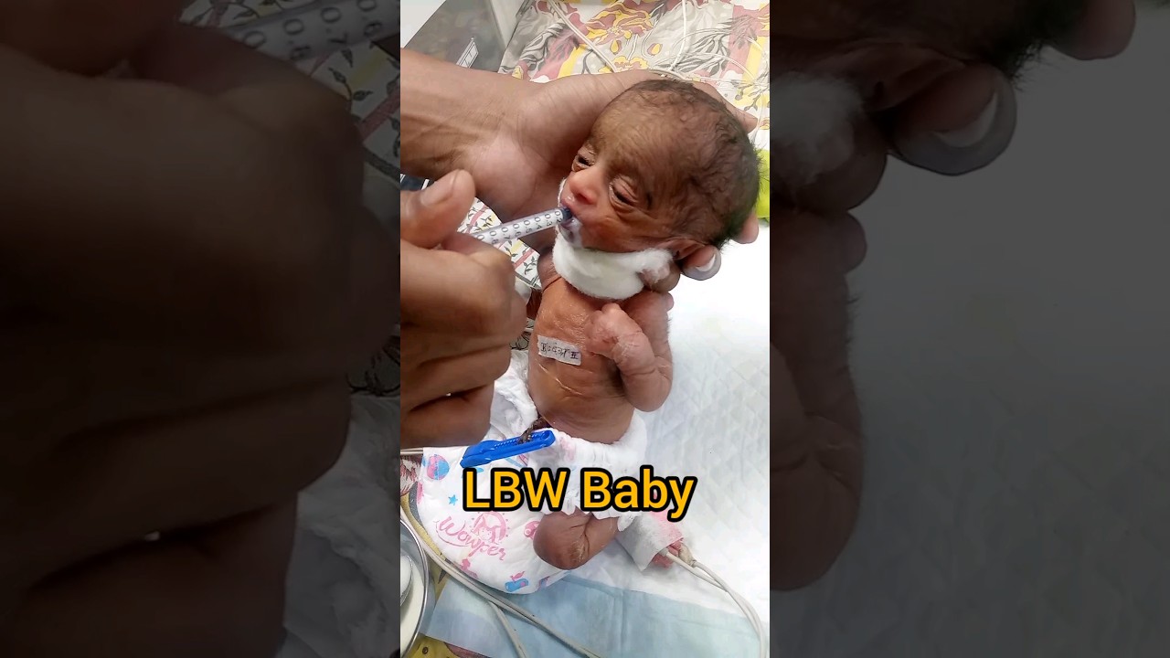 So cute 🥰 baby NICU #youtubeshorts #short #nicu #cutebabycarebaby