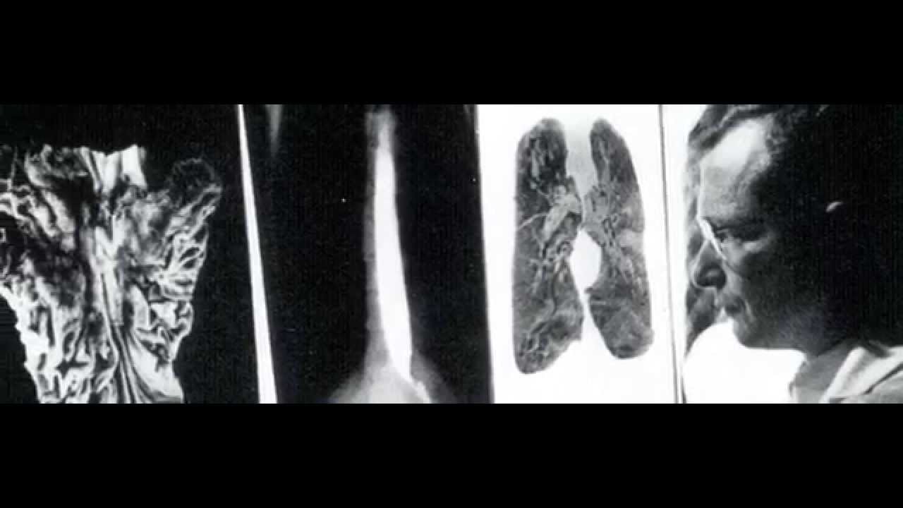 RSNA: 100 Years of Research