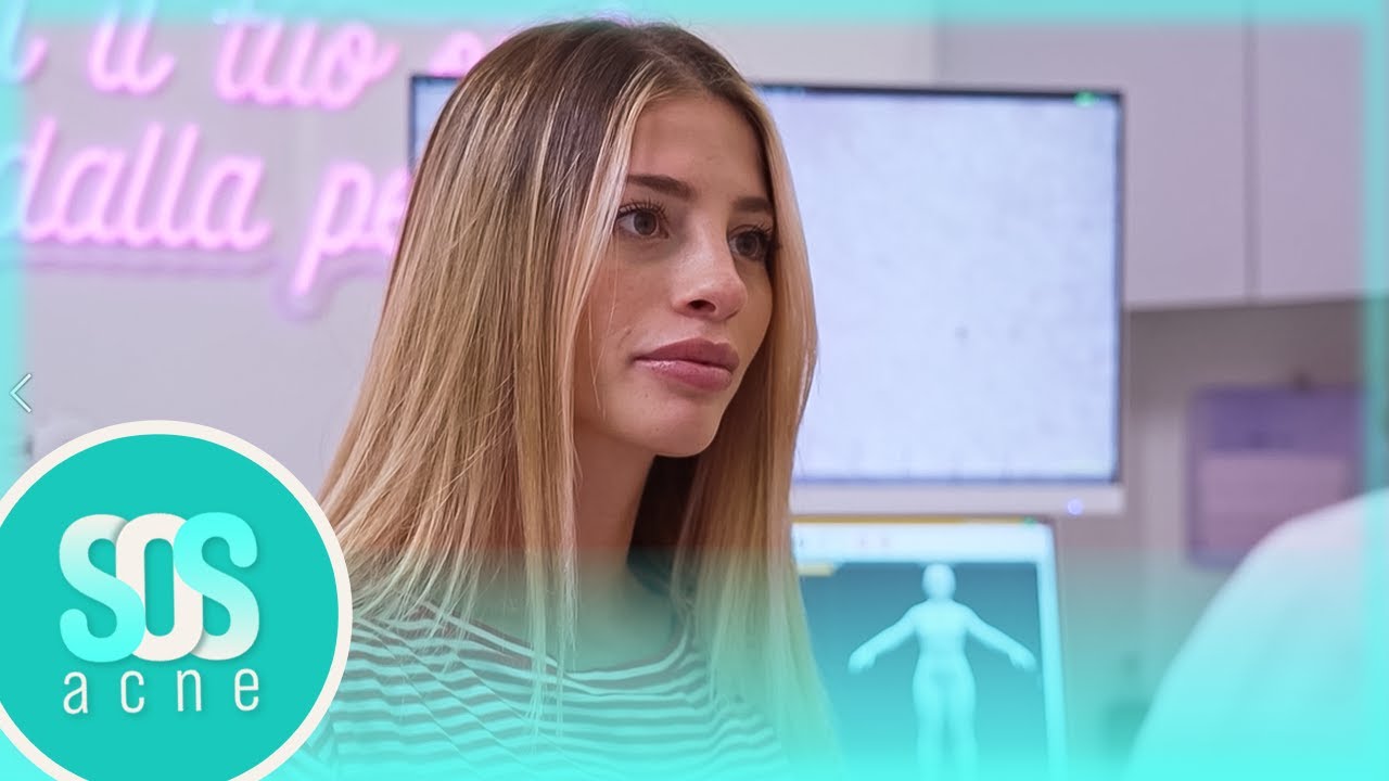 Chiara Nasti ha la pelle troppo secca | Sos Acne