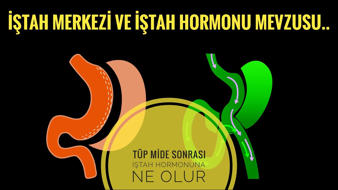 İştah merkezi ve iştah hormonu MEVZUSU.. (Tüp mide ve gastrik bypass)