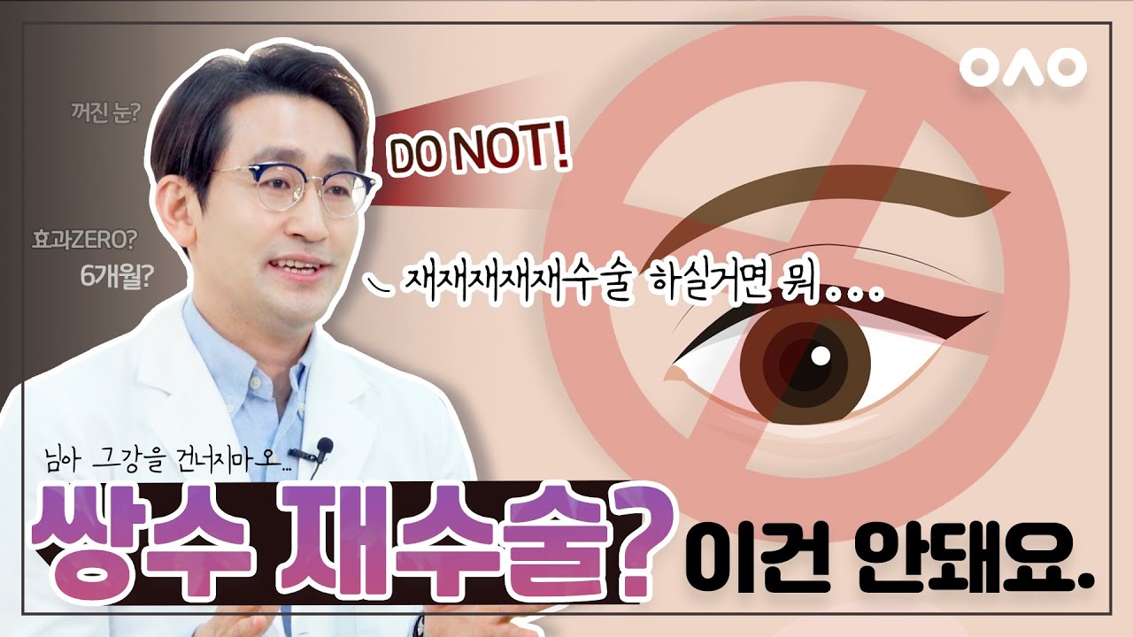 눈재수술 불가능한 경우 제발 알고 가세요!