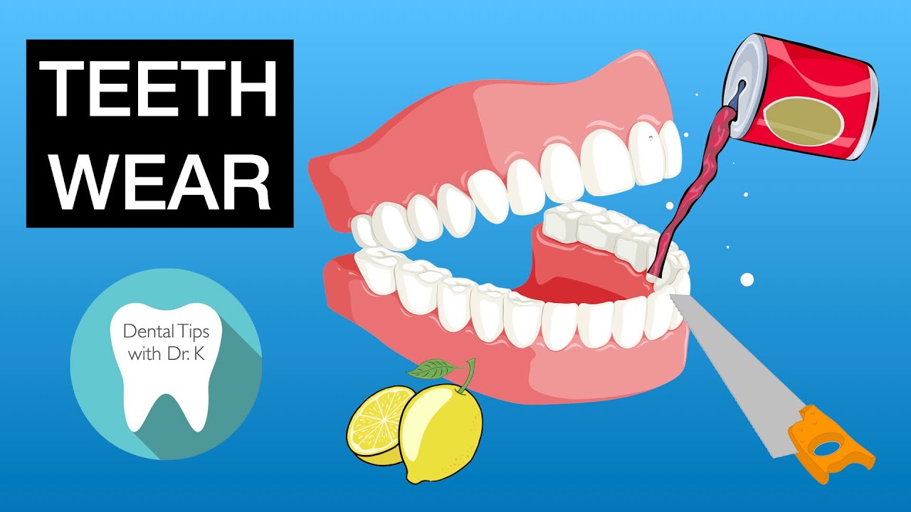 Tooth Wear