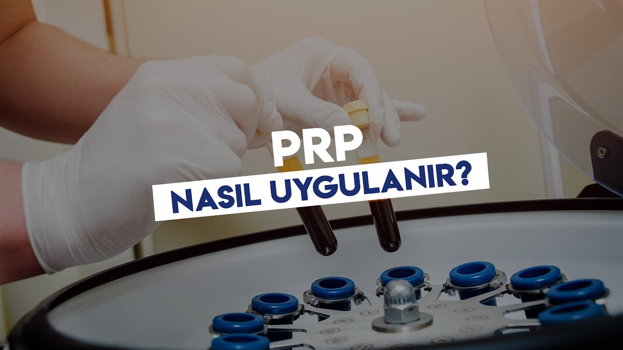 PRP nasıl uygulanır? | Op. Dr. Hünkar Batıkhan