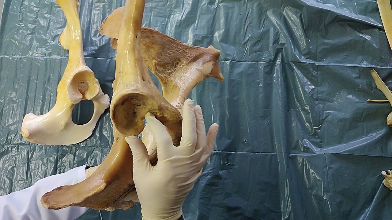 Ossa Coxae