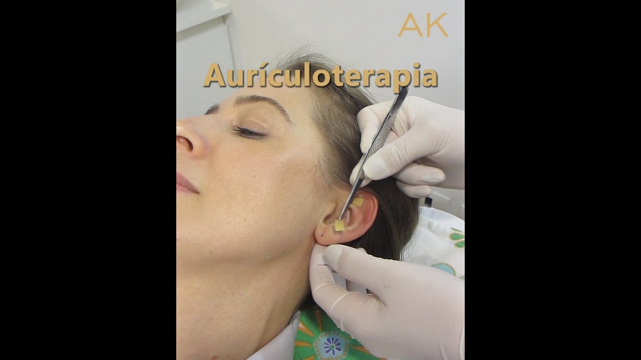 Aur&iacute;culoterapia