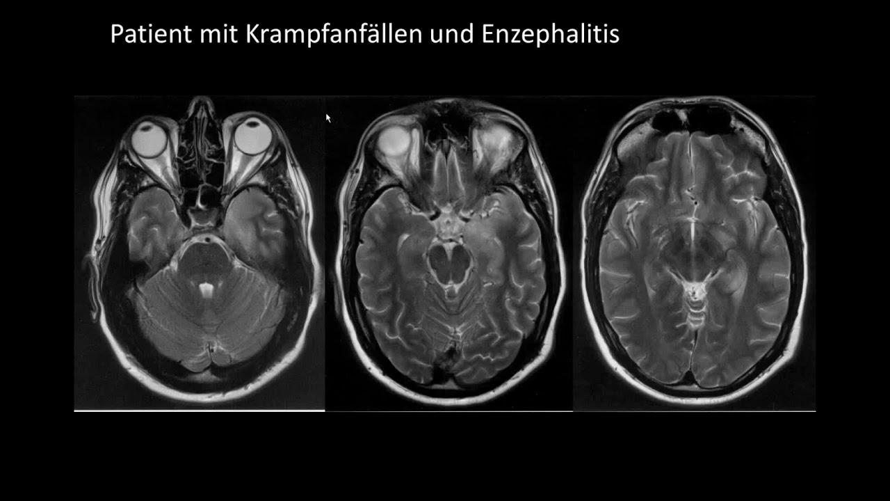 Keine Angst vor Röntgenbildern im Hammerexamen - Teil 2 | DRG