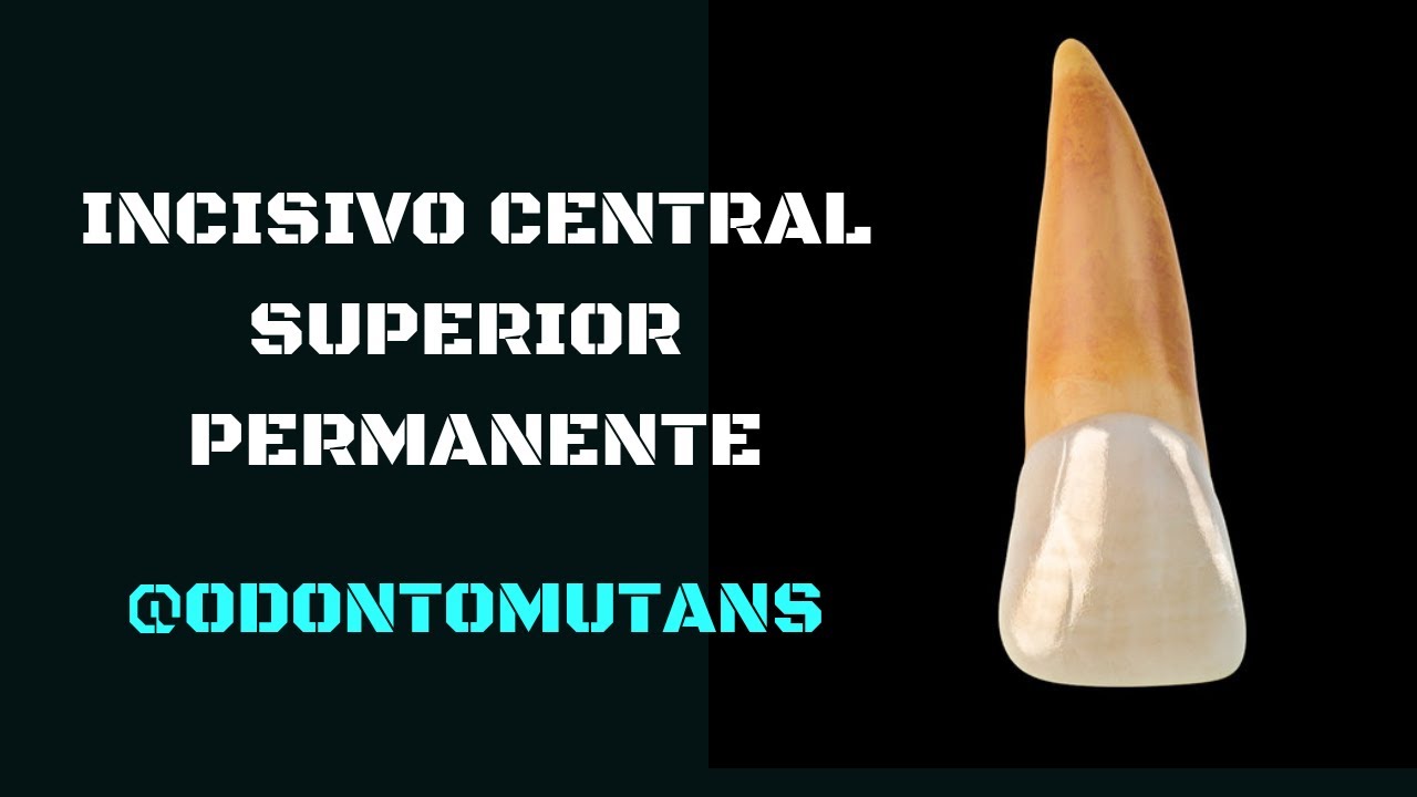 INCISIVO CENTRAL SUPERIOR PERMANENTE