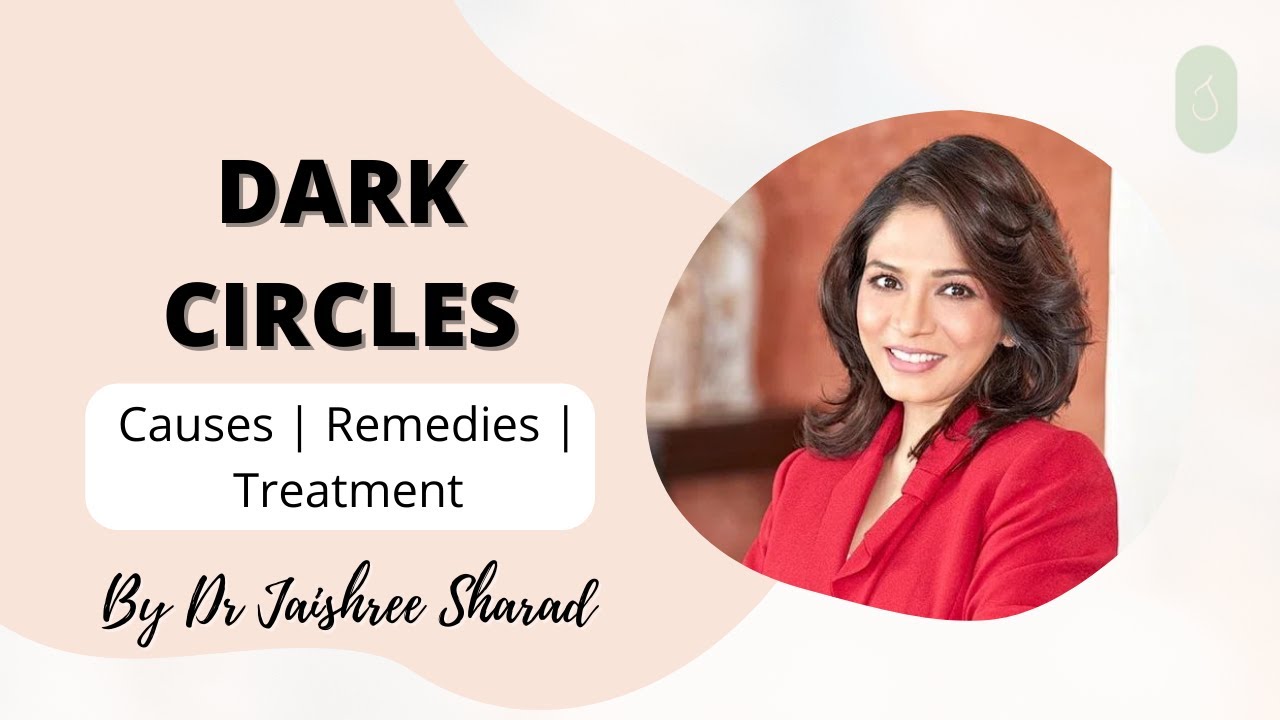 Dark circles | Causes | Remedies | Treatment