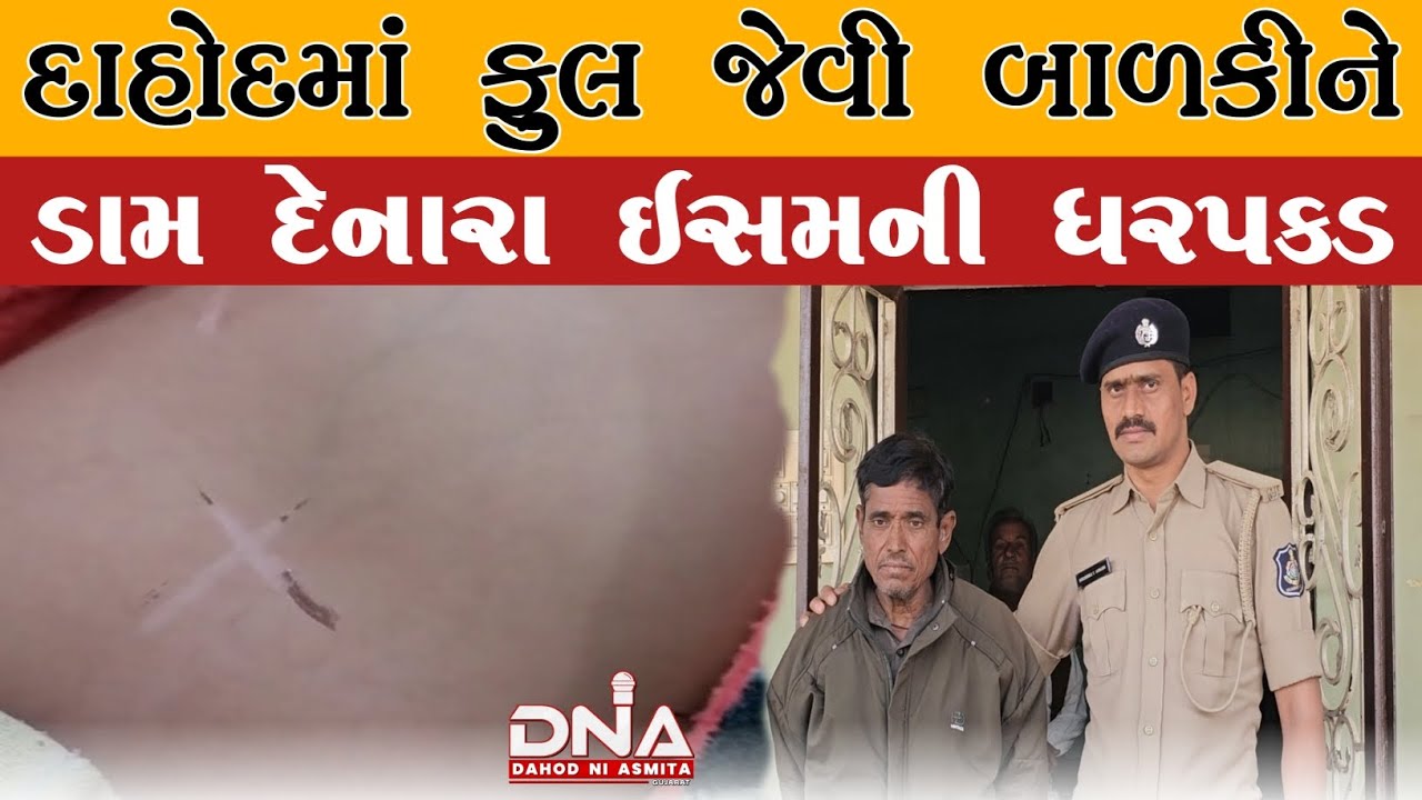 દાહોદ:બીમાર બાળકીને ડામ દેવાની ઘટનામા કતવારા પોલીસે આરોપીની ધરપકડ કરી #dahodpolice #dnadahodniasmita
