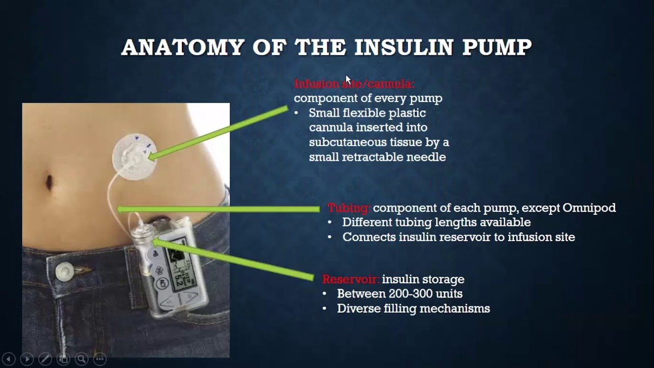 Endocrinology Webinar: Diabetes Technology