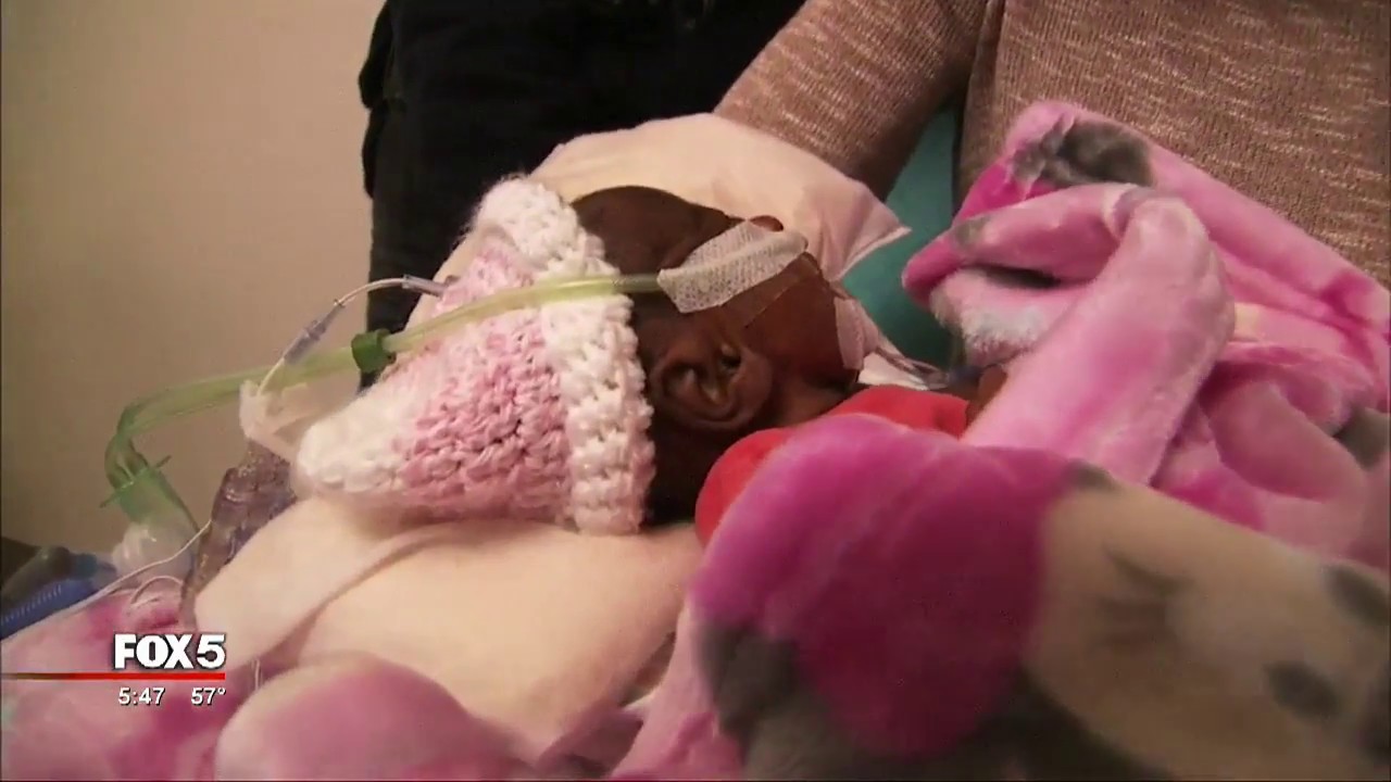 Georgia mom talks about life with a 'micro preemie'