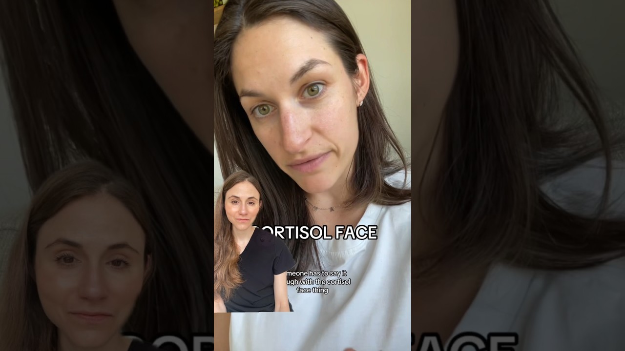 You Don&rsquo;t Have Cortisol Face