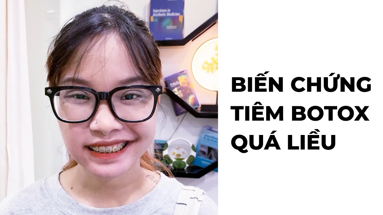 Đơ cứng cơ mặt không thể cười vì tiêm Botox quá liều | Biến chứng sau tiêm botox mặt Vline (P1)