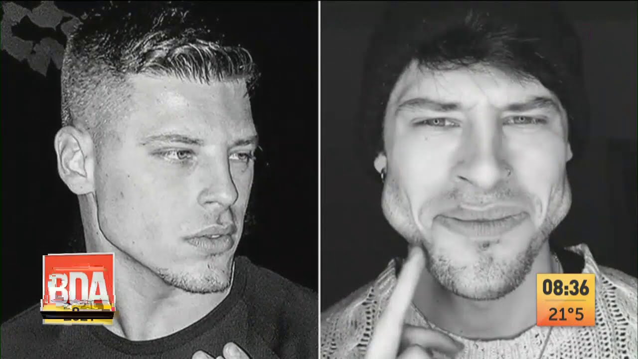 Un modelo italiano deformó su cara entrenando la mandíbula
