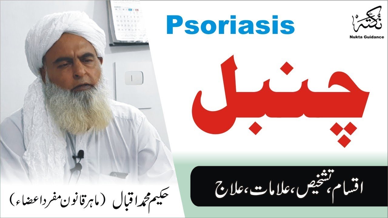 Psoriasis ka Elaj ● چنبل کا علاج ● सोरायसिस ● সোরিয়াসিস ● Hakeem Muhammad Iqbal