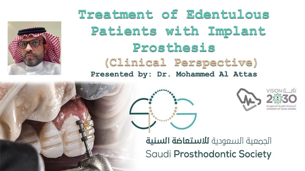 Treatment of Edentulous Patients with Implant Prosthesis (Clinical Perspective)