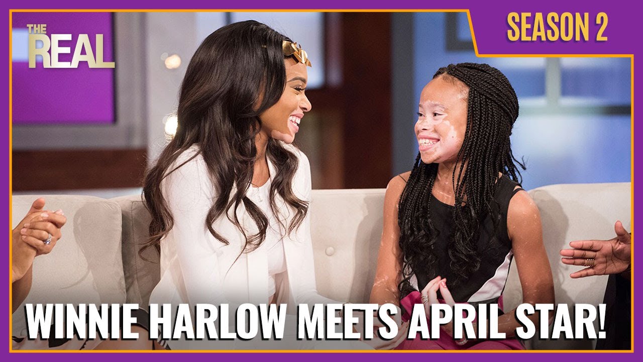 [Full Episode] Winnie Harlow Meets April Star!