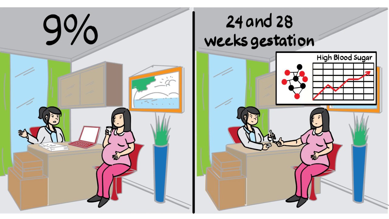 Diabetes during Pregnancy: how exercise can help!