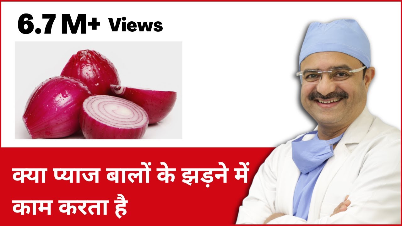 Effectiveness of Onion Juice in Hair Loss (क्या प्याज बालों के झड़ने में काम करता है) | (In HINDI)
