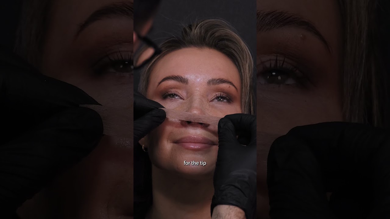 How to Tape the Nose after a Rhinoplasty I Nose Taping to Reduce Swelling After Nose Job