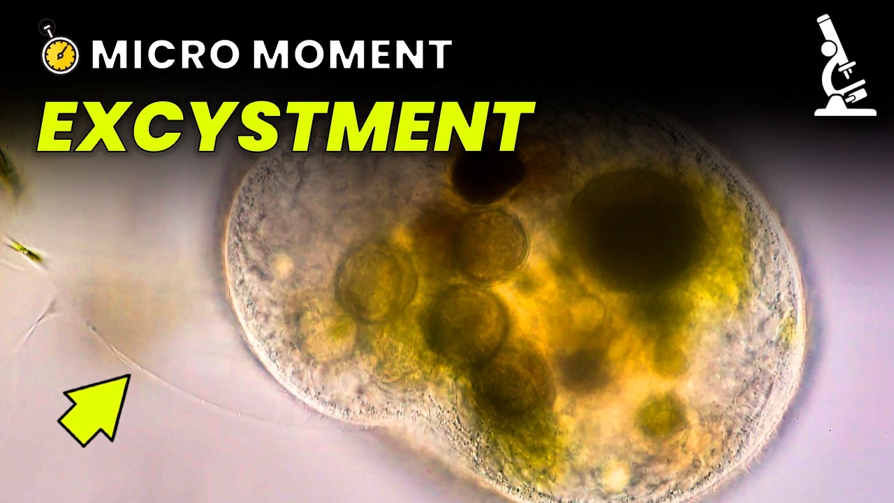 Ciliate Emerges from Its Cyst | A Micro Moment