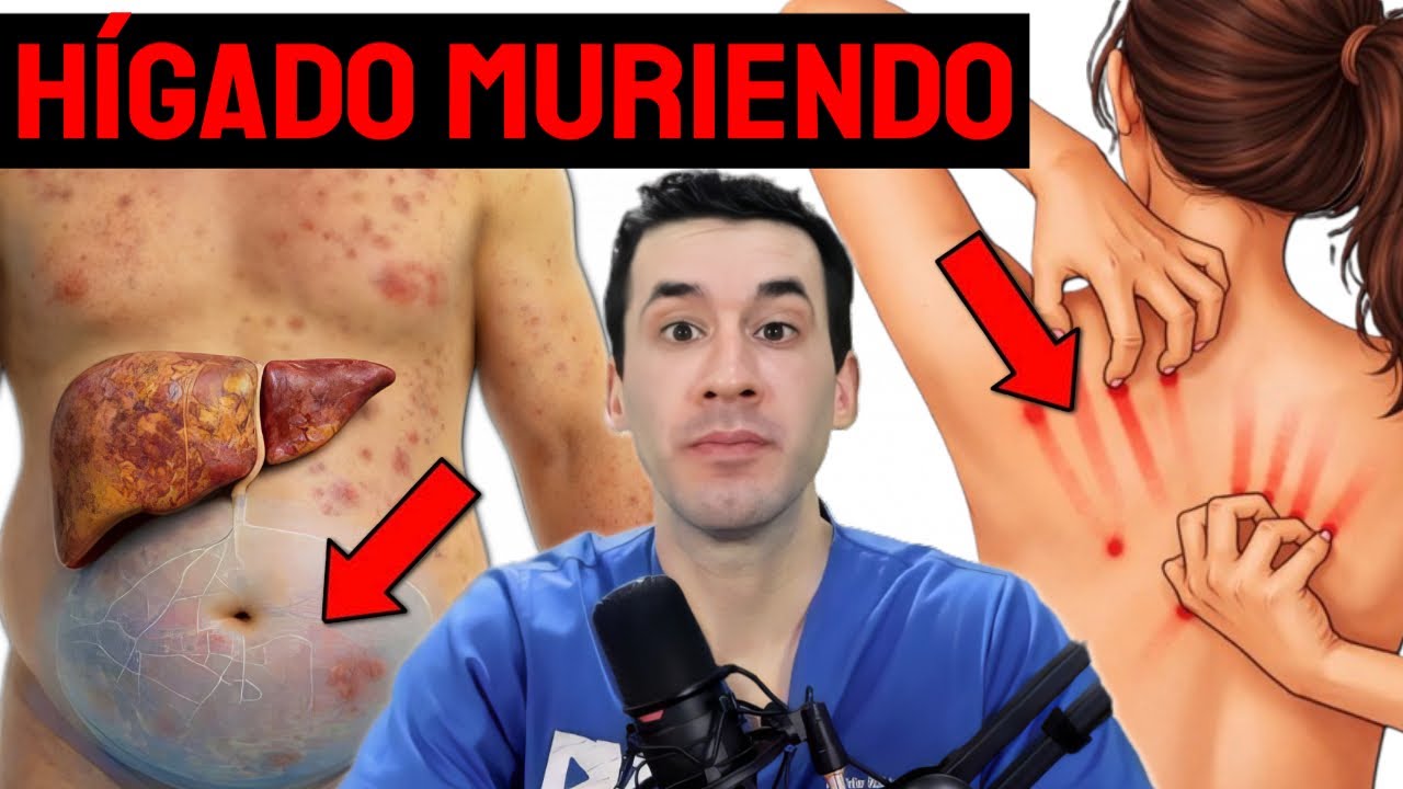 10 SIGNOS TEMPRANOS DE DA&Ntilde;O HEP&Aacute;TICO