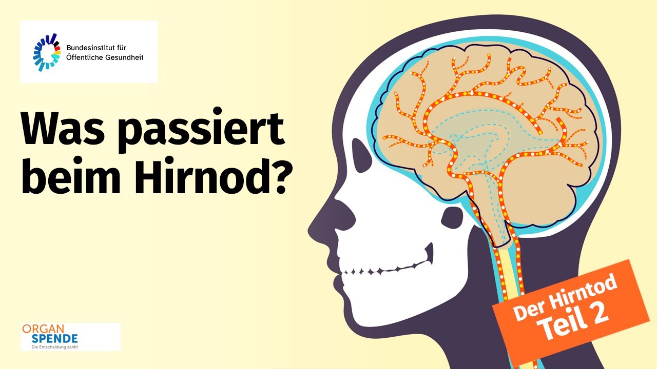 Der Hirntod - Teil 2: Was passiert beim Hirntod?