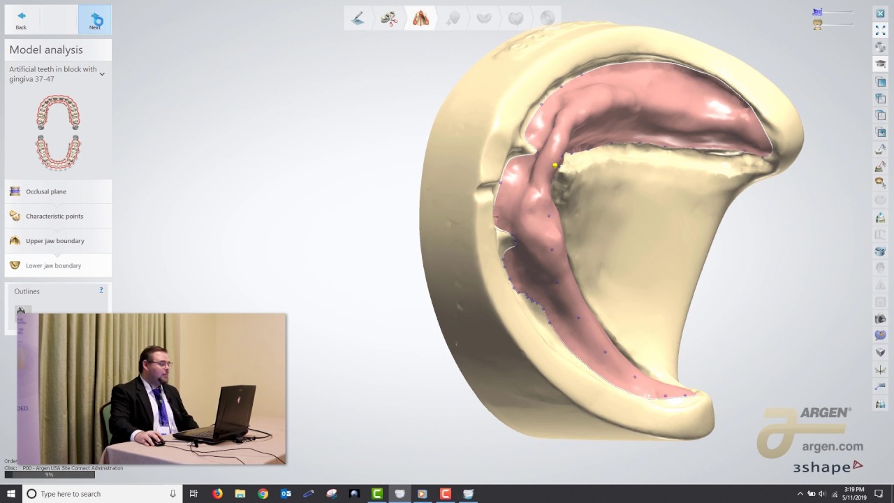 Digital Dentures: A Crash Course on How to Design using 3Shape - Logan Woomer
