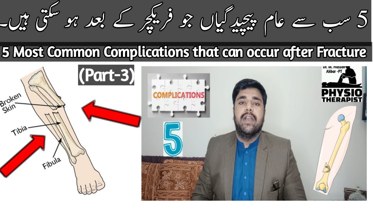5 Complications that can occur after the Fracture ? || 5 پیچیدگیاں جو فریکچر کے بعد ہو سکتی ہیں؟ ||