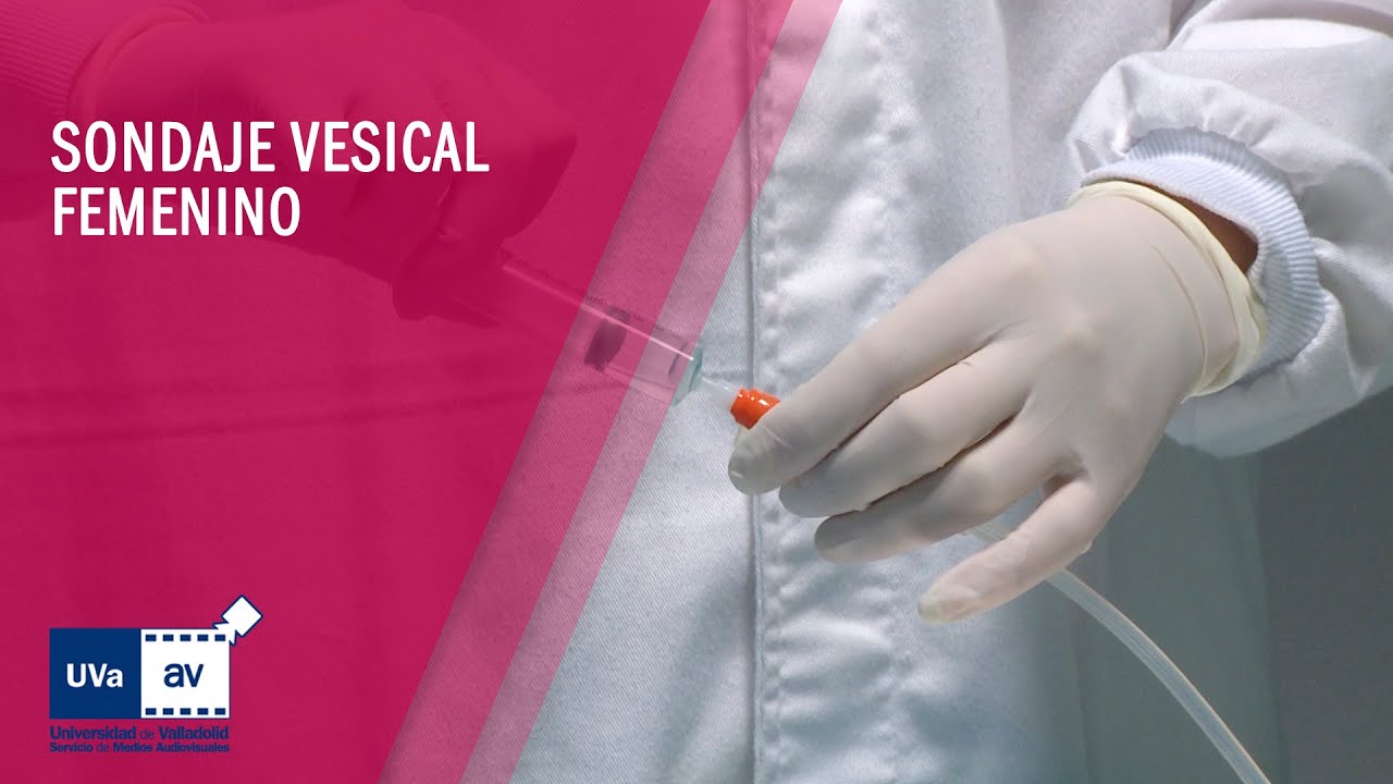 SONDAJE VESICAL FEMENINO