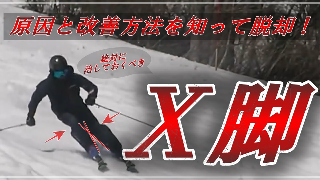 【要脱却！】スキーでX脚になる原因と改善方法を知って解消しよう！
