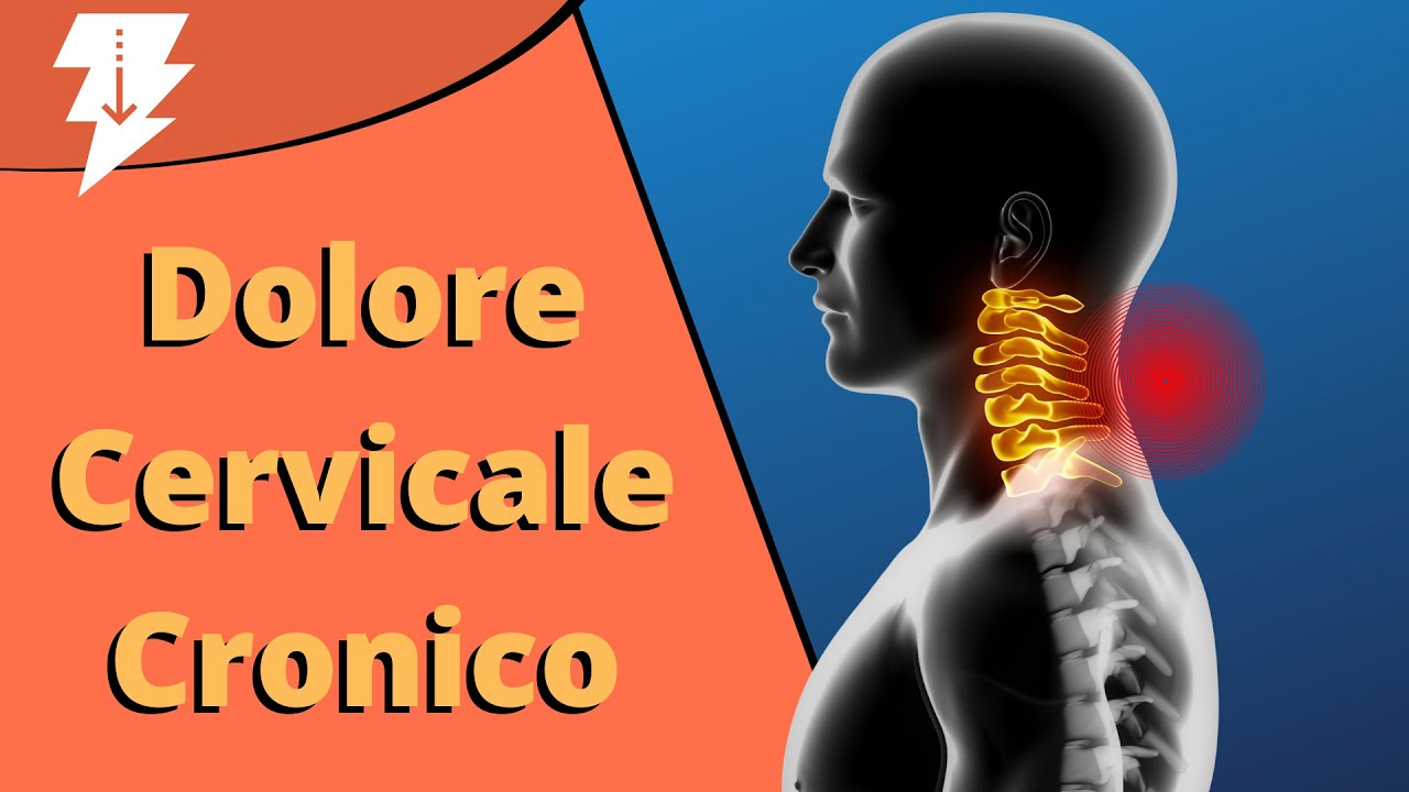 Dolore cervicale cronico | Come risolvere DEFINITIVAMENTE