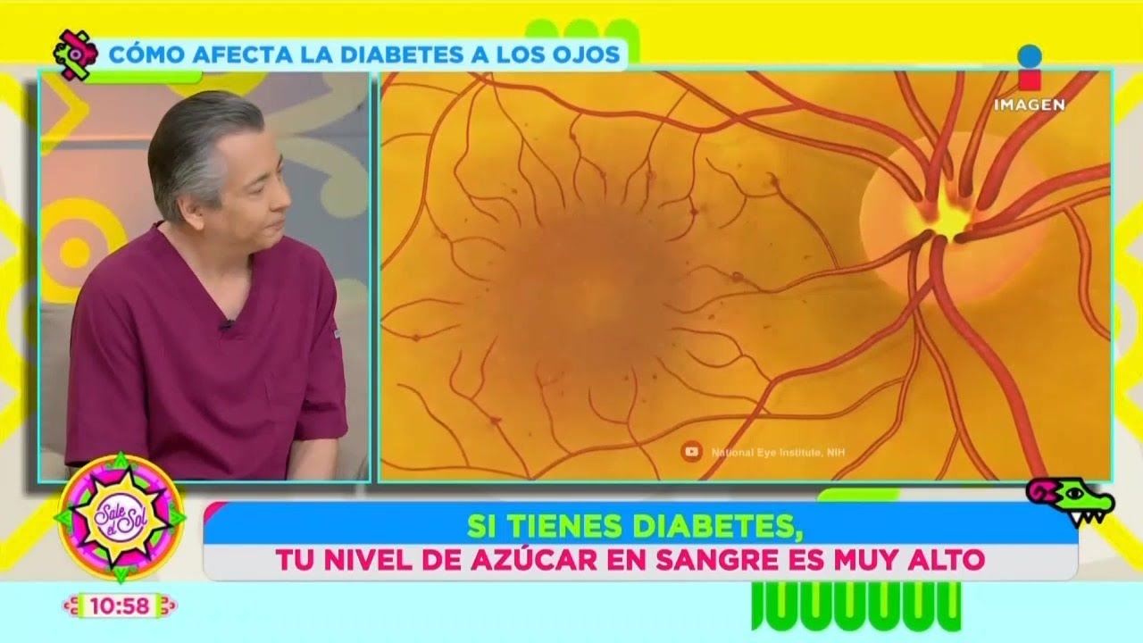 ¡Así afecta la diabetes a tu vista! | Vista de Doctor | Sale el Sol