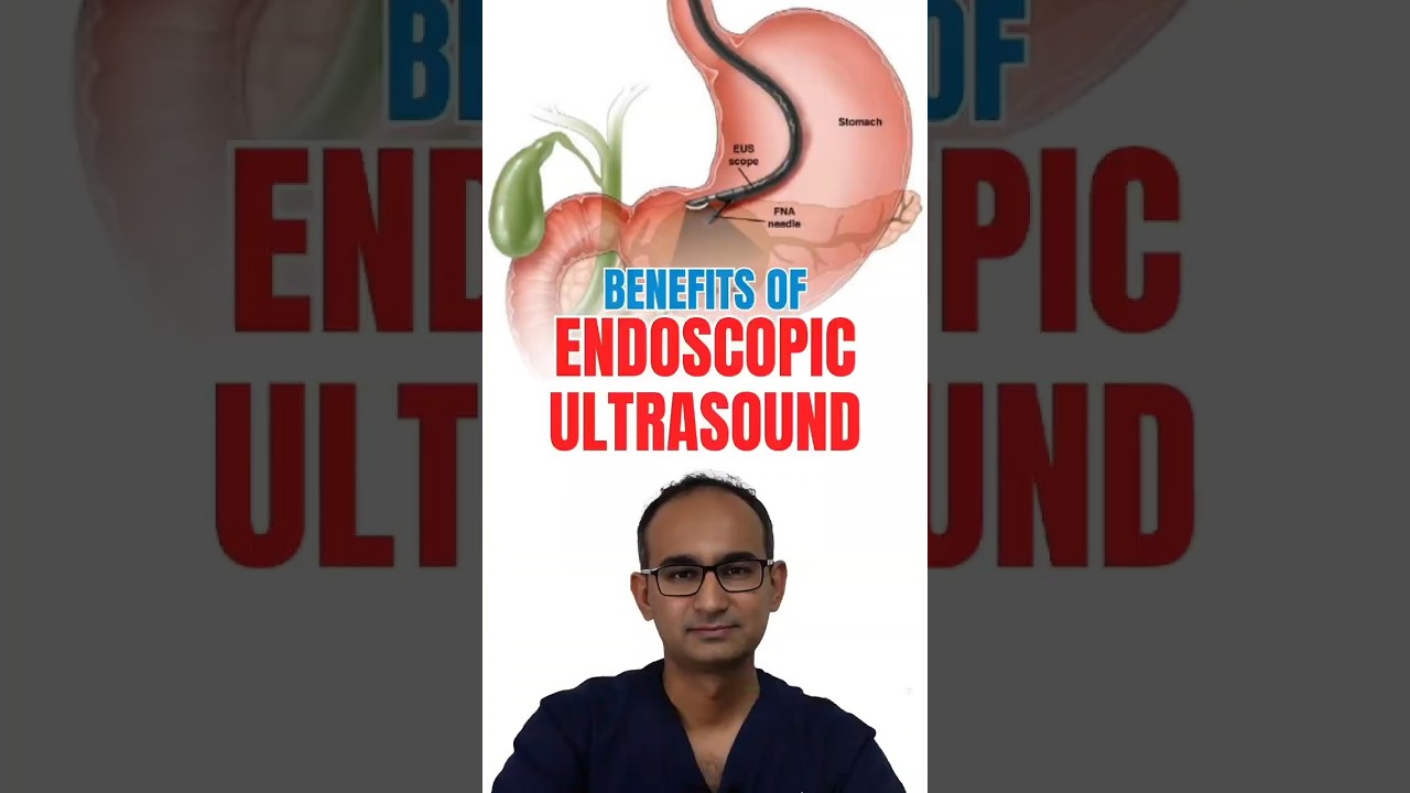 Benefits of Endoscopic Ultrasound (EUS) | Dr. Paithankar Gastro Clinics