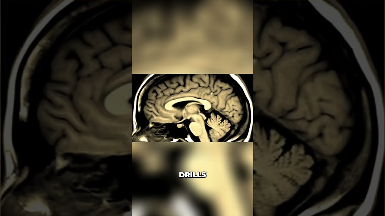 ADHD + Cluster C: The Ultimate Habit-Breaking Disaster 