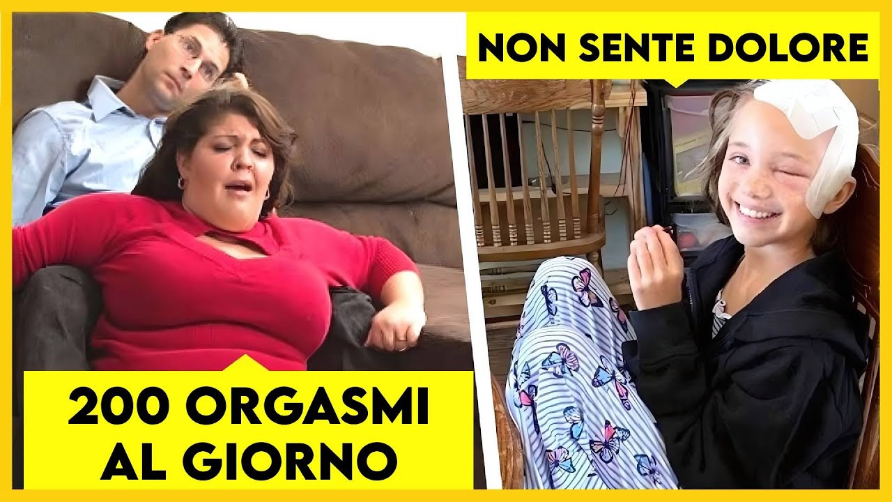 10 MALATTIE PI&Ugrave; STRANE DEL MONDO