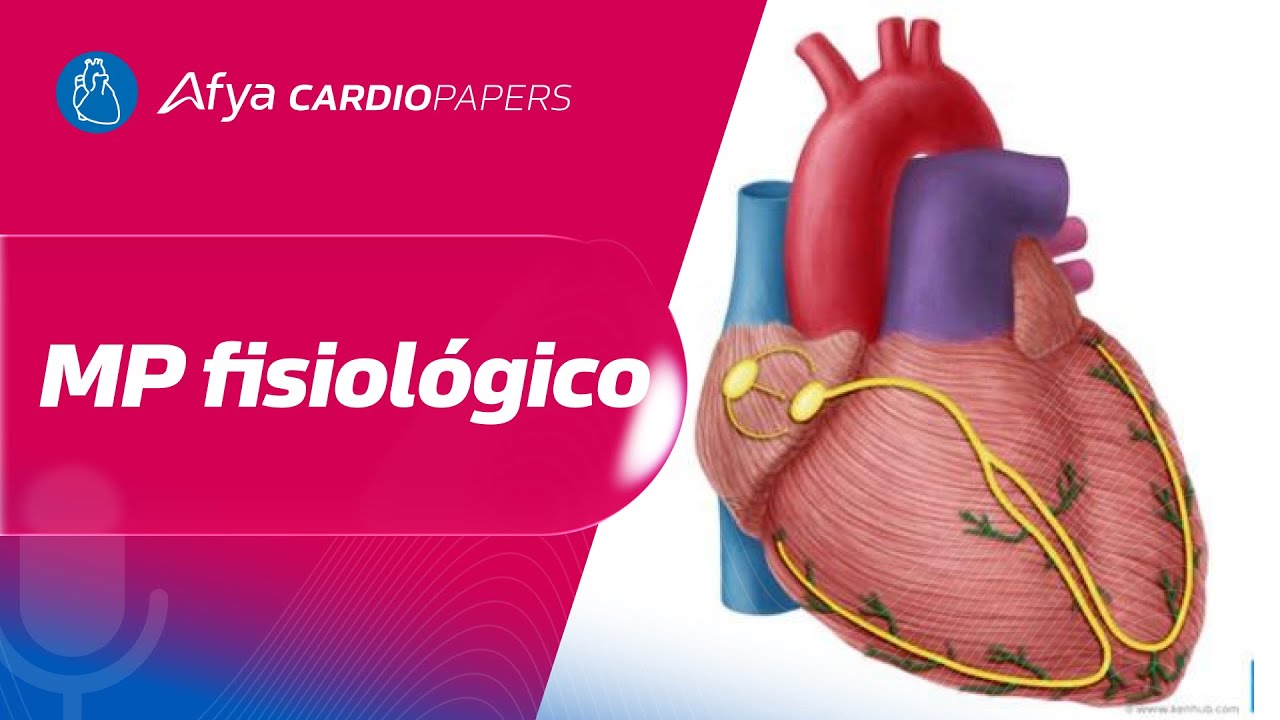 Marcapasso com estimulação fisiológica explicado